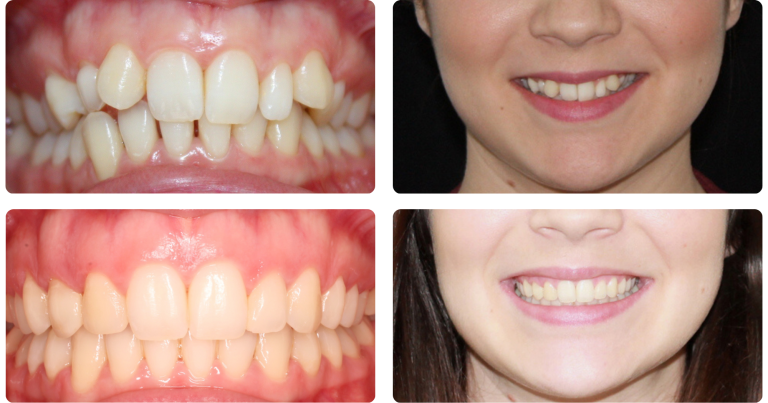 Dolor articular y sonrisa Dra. Guadalupe Martínez Robustillo