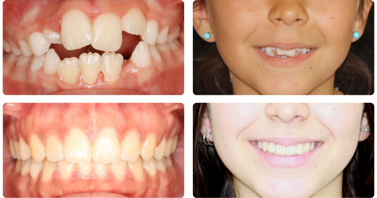 Ortodoncia infantil y adultos Clínica dental Zafra