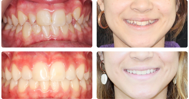 Sonrisa estética l Dra. Guadalupe Martínez Robustillo