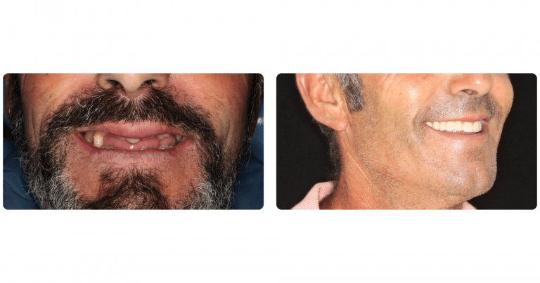 Caso tratamiento dental Dra. Guadalupe Martínez