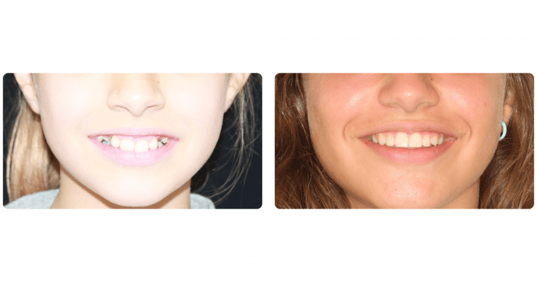 Caso tratamiento Clínica dental Zafra